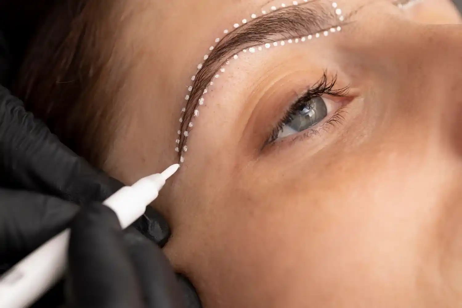 Podizanje obrva (brow lift) — hirurška procedura, Dr Ivana Kostić Beograd