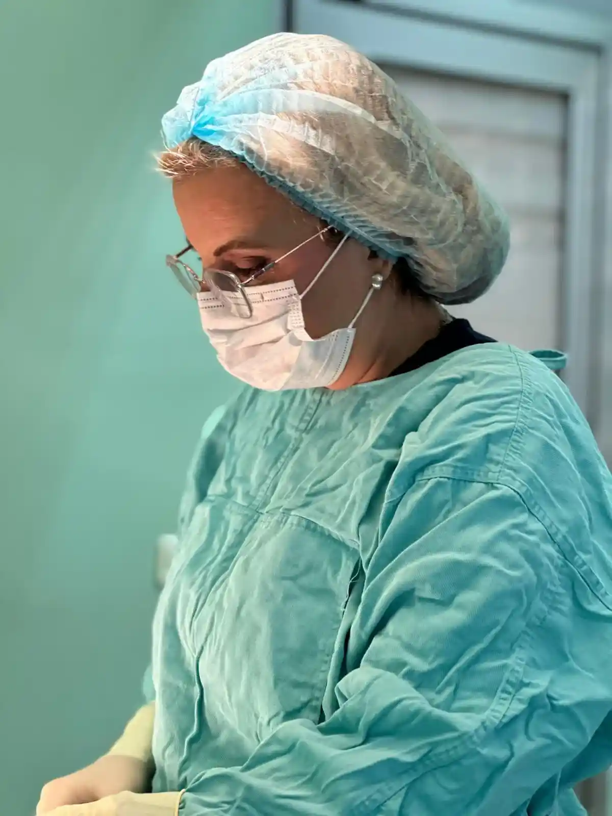 Estetska hirurgija lica — lipofiling, Dr Ivana Kostić Beograd
